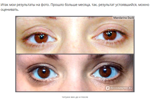 Фотографии ДО и ПОСЛЕ татуажа век