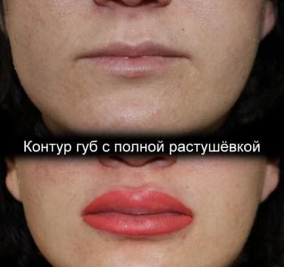 _