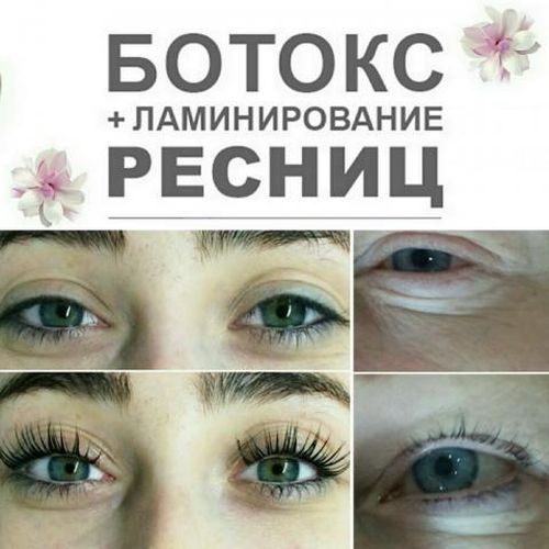 Биоламинирование ресниц что это такое, преимущества и недостатки процедуры