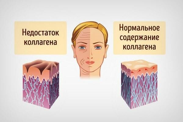 Коллаген для кожи вокруг глаз