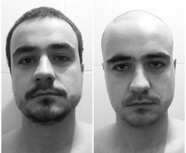 до и после результат