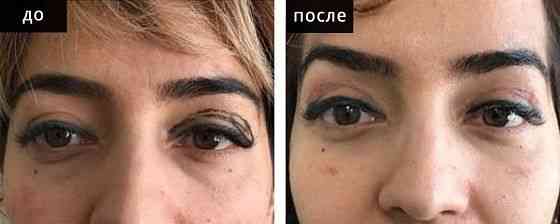 Асимметрия бровей: причины и способы коррекции