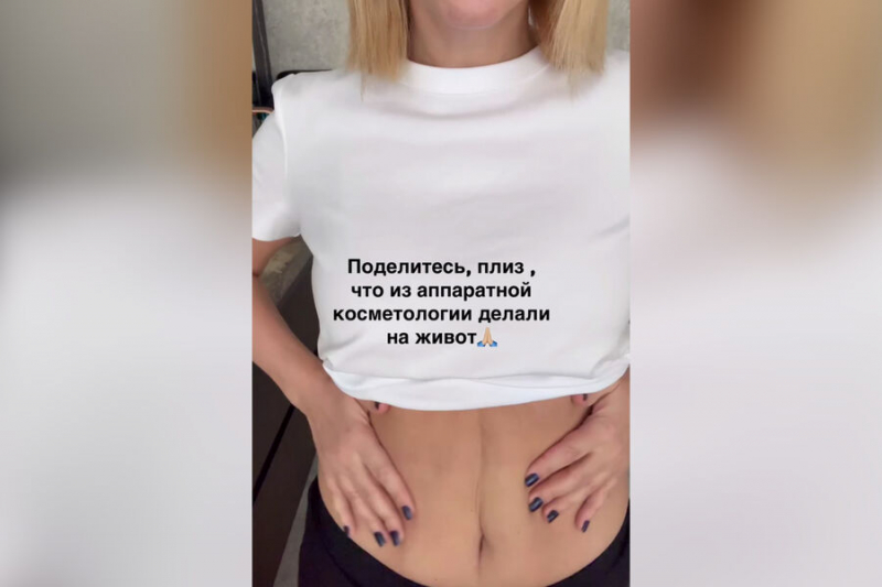 Орлова показала, как выглядит ее живот через два года после родов: «Не восстановился»